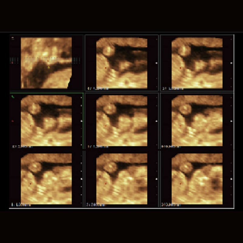 CBit 4 Ultrasound System