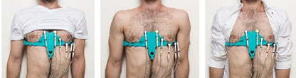 LevMed AllBrand ECG Electrode Belt