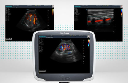 SonoScape S11 Plus ultrasound system without battery