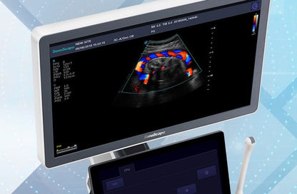 Sonoscape P15 Ultrasound Machine without battery