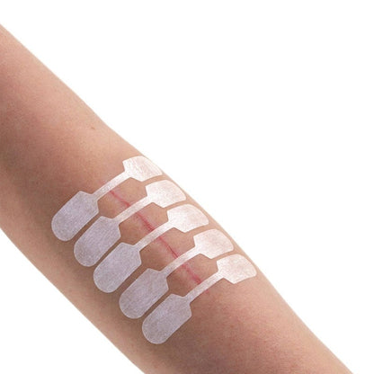 Sterigrap Wound Closure Strips Strips, 75 x 3 mm (10 PCS)
