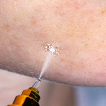 Cryoalfa SUPER Liquid | in case