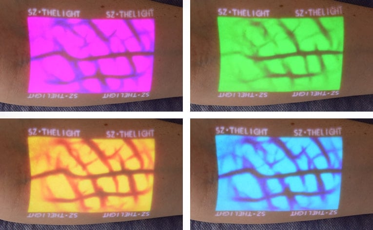 Enmind VV-100 Vein Viewer