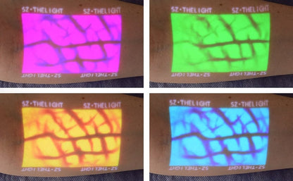 Enmind VV-100 Vein Viewer