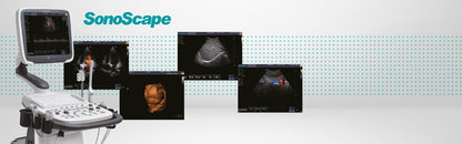 SonoScape S11 Plus ultrasound system battery included